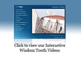 https://www.doctorsoms.com/wp-content/plugins/pbhs-video-player/assets/img/wisdom-teeth-launch-button.jpg